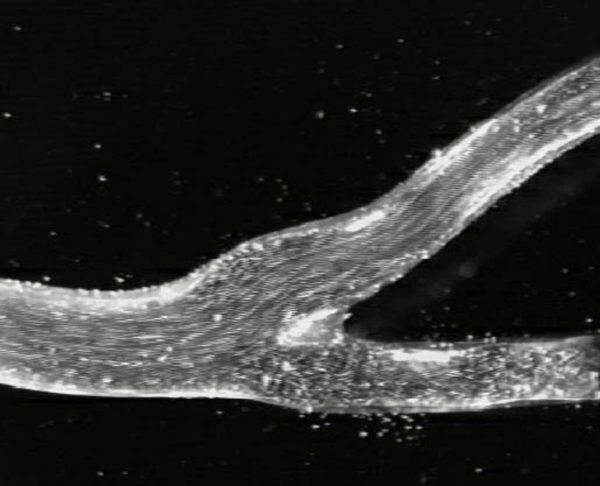 Cerebral carotid flow