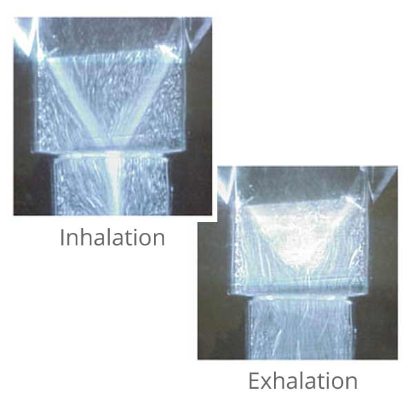 Medical Device Air Flow